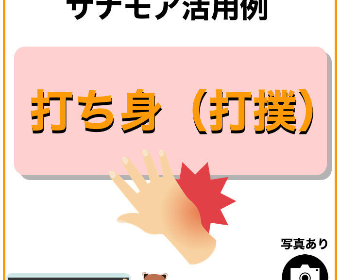 サナモア活用例【打ち身（打撲）】サナモアを使って早めに治しましょう！